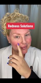 Redness isn’t going to stop me 😉 #cliniqueconsultant #rednesssolutions  #consultantcontentcollective