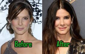 It up against a random cosmetic surgery procedure. Sandra Bullock Plastic Surgery Changed Her Nose Before After Celebritysurgeryicon