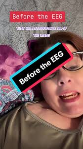 When you have an ambulatory EEG, there is a lot of preparation to make...