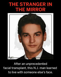 Joe DiMeo almost lost everything in a fiery car crash. His ears, hair, and  lips were gone and his fingers fused together. Chances of survival were  low, but miraculously he survived. But would he be ...