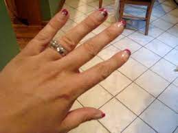 Also, you can't relax the twitching away. Finger Twitch Youtube