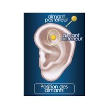 Dans mon livre, publié chez eyrolles, vous trouverez un guide « pas à pas » qui vous aidera à vous préparer tranquillement et efficacement en 21 jours pour arrêter de fumer dans le confort et pour de bon. Aimant Oreille Zerosmoke Arreter De Fumer Sevrage Cigarette Climsom