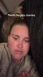 Stephanie Rao Surgery