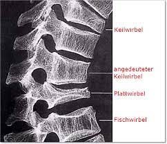 Osteoporose Diagnose Und Diagnostik