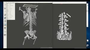 Encyclopedia of human body systems / julie mcdowell. Advanced Free 3d Printable Bone Creation Creating And Processing Multiple Models From A Ct Scan Youtube