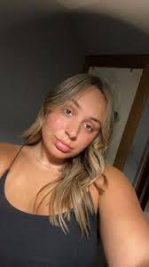 Scots therapist's confidence boost with non-surgical face treatment