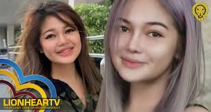 The weeknd covers 'billboard' by amber b things are pretty much looking well for the weeknd these days. Did She Undergo Cosmetic Surgery Janine Berdin Shocks Netizens With New Look Lionheartv