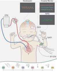 Image result for Neonatal Circulation Assessment