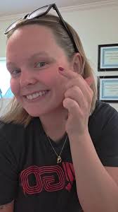 Crows feet tox 💉 , •••, 📞(762)303-0034, 👩‍💻 BoundlessBeautyATL.com,  📍326 Dahlonega St, Cumming, GA 30040, •••, #CummingMedSpa #Boundless  #Neurotoxin #Botox #Jeuveau #Dysport #Placement #Education ...