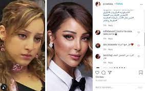 Jun 05, 2021 · تداول متابعون مقطع فيديو للفنانة المعتزلة بسمة بوسيل، زوجة النجم تامر حسني، بدت فيه وهي تكشف حقيقة عمليات التجميل التي خضعت لها في الوجه بعد أن تعرضت Ù‡Ù† ØªØ¯Ø§ÙˆÙ„ ØµÙˆØ±Ø© Ù„Ù€ Ø¨Ø³Ù…Ø© Ø¨ÙˆØ³ÙŠÙ„ Ù‚Ø¨Ù„ ÙˆØ¨Ø¹Ø¯ Ø§Ù„ØªØ¬Ù…ÙŠÙ„ ÙˆÙ…ØªØ§Ø¨Ø¹ÙˆÙ† Ù†Ù‚Ù„Øª Ø§Ù„Ø­Ø³Ù†Ø©