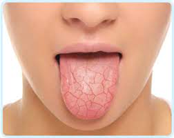 If it is affecting both sides, you certainly don't need to worry about cancer. I Have A Dry Mouth What Does That Mean Trailhead Dental