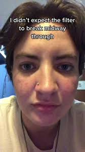 TikTok said check yourself  #filter#face#facezoom#whatiactuallylooklike#face#zoomedin#zoomedout#brokenfilter#filterbroke#pajamas#pjs#fyp#ugly#poorposture