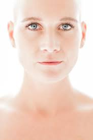 Model Sandra (30) uit Rijssen verloor in 4 dagen al haar haren: 'Dit is  mijn kaalverhaal'