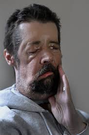 Tragedies to transplants, the history of Longwood