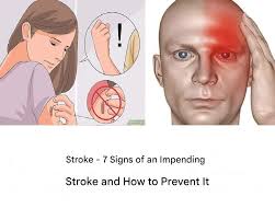 Stroke warning signs to not ignore
