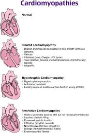 Nursing Cardiomyopathies More Cardiac Nursing Cardiology Nursing Nurse