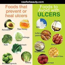 How to tell if you have an ulcer. 12 Best Food For Those With Ulcers Ideas Ulcers Food Gastritis Diet