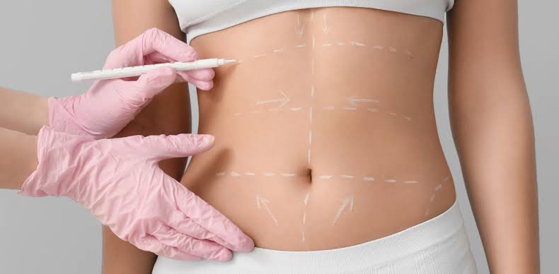 Tummy Tuck Costs in Northern Virginia - Younger Image Plastic Surgery Center
