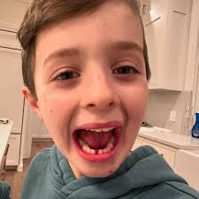 Two in, two out 🦷 First lost tooth (teeth)