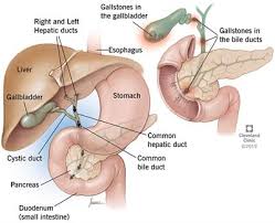 That big scary word (and big scary cost) simply means that the veterinarian will surgically form this surgery is done to remove the gallbladder completely. Gallstones Treatment Definition Risk Factors Symptoms