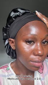 Here’s my honest review from using the @medicube_official zero pore pad 2.0 