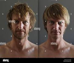 Beard before after immagini e fotografie stock ad alta risoluzione