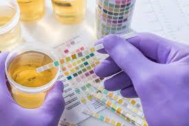 Maybe you would like to learn more about one of these? Ciri Ciri Urine Yang Normal Menurut Warna Bau Dan Jumlahnya