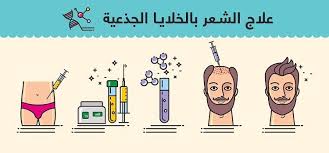 ابر الخلايا الجذعية للشعر في جدة مركز الخلايا الجذعية في جدة تجميلي