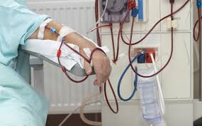 Kidney Dialysis What You Should Know