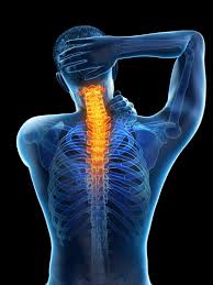 Image result for Neck Pain