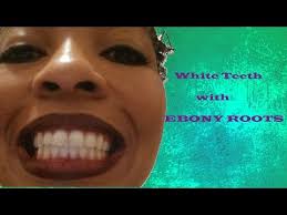 white teeth with baking soda & coconut oil