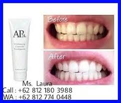 Pin On High Class Wa 62 812 774 0448 Telkomsel Pasta Gigi Pemutih Gigi
