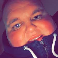 Leaflets urge chip shops not to serve obese takeaway fan, 27, after 'life  or death' health warning