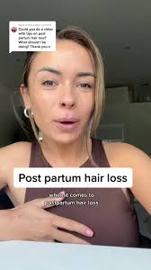 Replying to @Siân Cook post partum hair shedding explained  #postpartumhairloss #hairlosshacks #hairregrowthtips