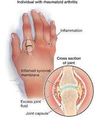 Pin On Health Wellness