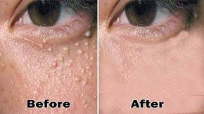 Pin On Skin Remedies