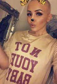 GALERIE: Na prvním rande si sundala paruku a odhalila holou hlavu.  Podívejte se, jak zareagoval!