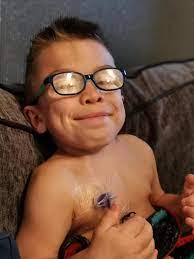 So This Is What Josh S Hope Maroteaux Lamy Syndrome Facebook