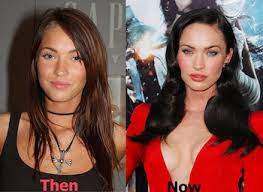The actress has never spoken. Megan Fox Plastic Surgery