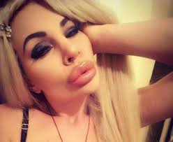 Crazy Huge Lips Fail: Girls Who Took Lip Injections A Little Too Far