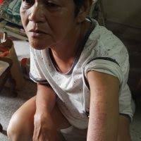 Underprivileged Family Case: FC-15-03 Chan Siew Cheng