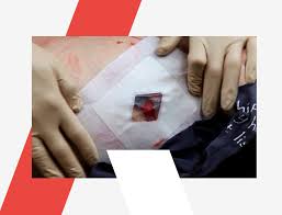 Image result for Chest Trauma