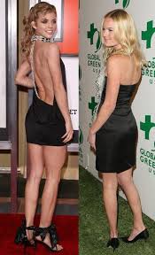 The Hottest Girl In A Short Black Dress Is Annalynne Mccord Vs Kate Bosworth Young Thin And Blonde Celebs In Sho Black Short Dress Dresses Chic Outfits