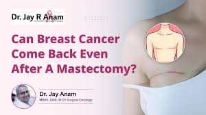 Image result for Mastectomy