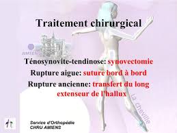 La majorité des cas de tendinite et de ténosynovite disparaissent après un repos approprié, l'application de compresses chaudes ou froides et la prise de la ténosynovectomie permet de soulager l'inflammation à long terme grâce à l'extraction de la synovie de la gaine du tendon. Les Teno Synovites De La Cheville Ppt Video Online Telecharger