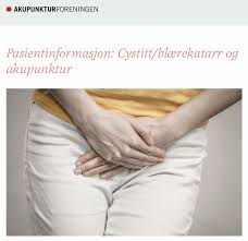 Hvis du er i tvil, kan du kontakte lege for å få en diagnose. Facebook