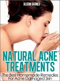 Natural Acne Treatments: Home Remedies For An Acne Cure. Treatment of  Teenage Acne, Adult Acne, Acne Scars and Back Acne by Alison Barnes
