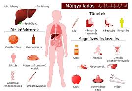A szívizomgyulladás egy súlyos betegség, amely komoly szívkárosodást okozhat. Izom Es Izuleti Fajdalom Hepatitisz Majgyulladas