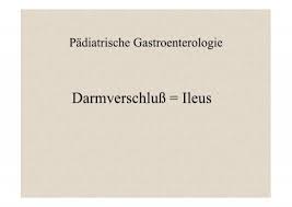 When do you start to feel symptoms of ileus? Darmverschluss Ileus