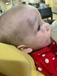 Falkville man indicted for 'striking' baby, family seeks justice